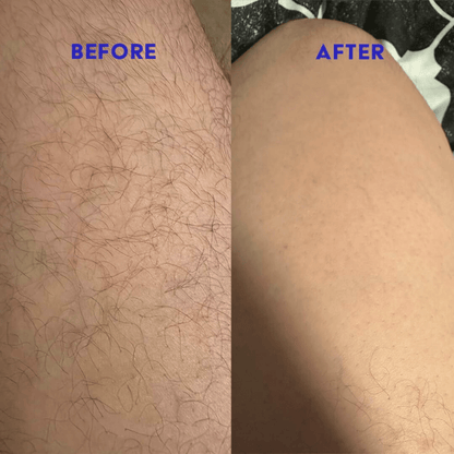 Runway Smooth™ Precision Dual Head Trimmer